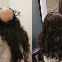 hairspec
